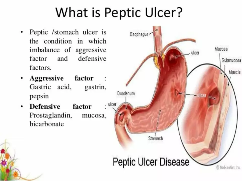 The Role of Acotiamide in the Management of Peptic Ulcer Disease